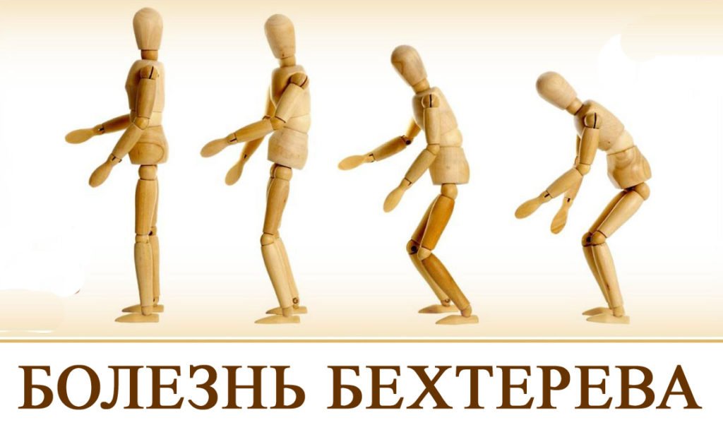 bolezn-behtereva